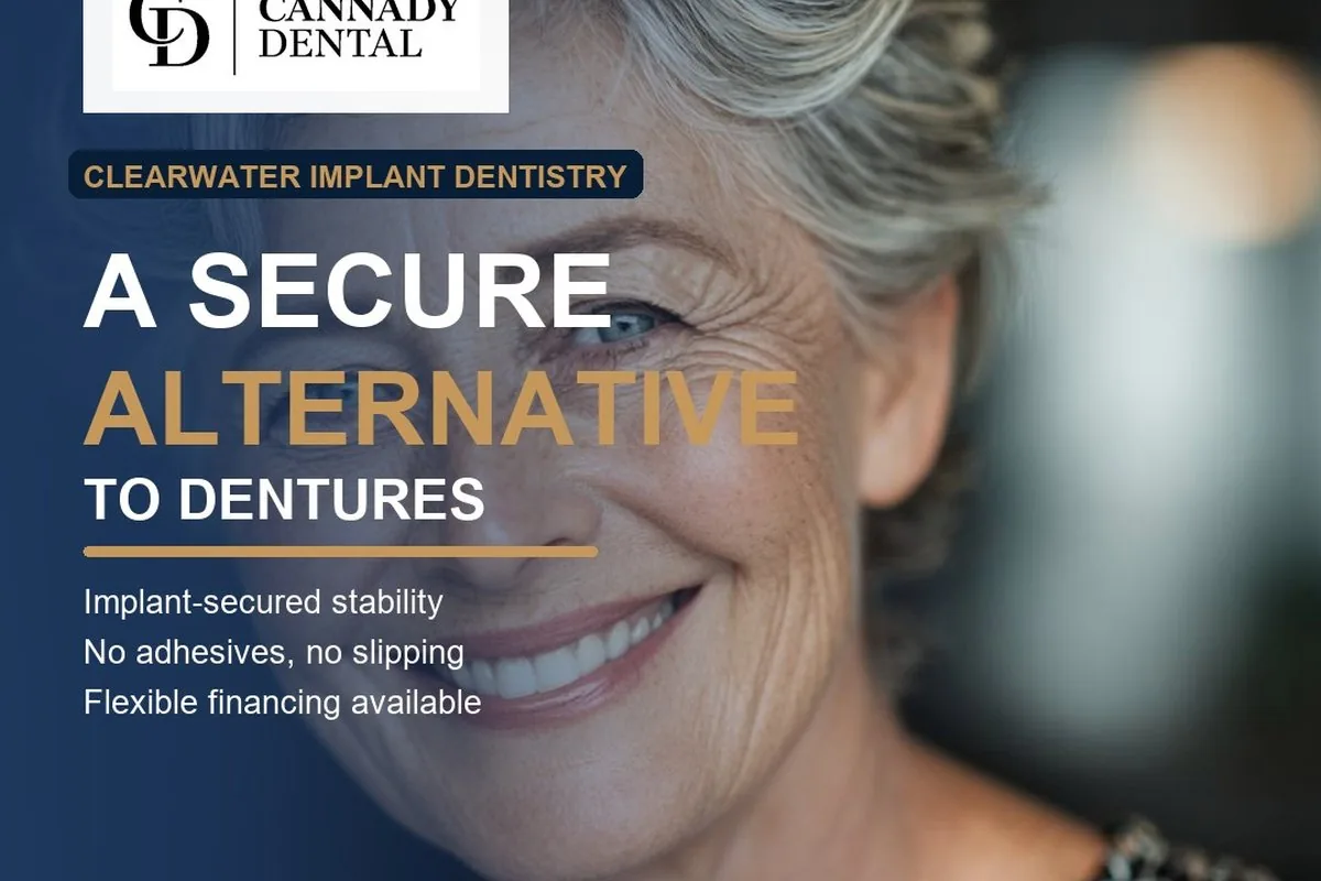 How Much Do Dental Implants Cost in Clearwater, FL?